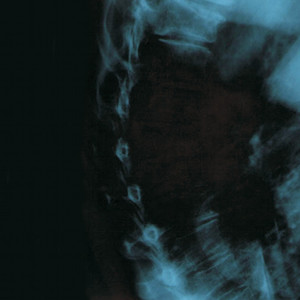 Ea II cover