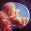 Embryo cover
