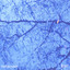Blue Albumcover