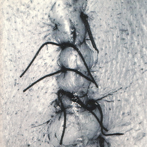 Infliction Albumcover