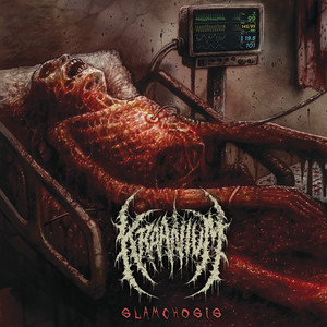 Slamchosis cover