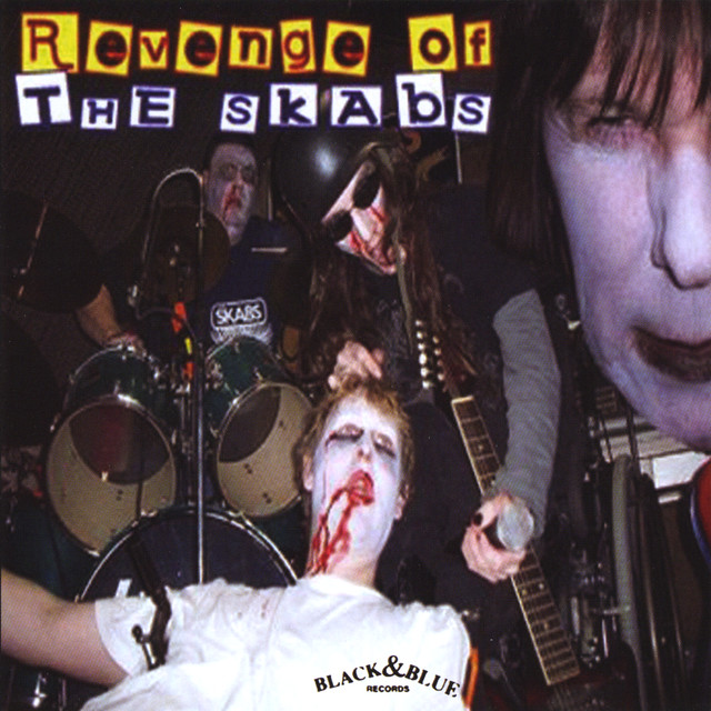 The Skabs Photo